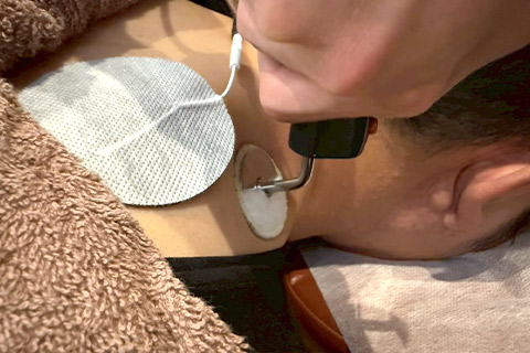 ハイボルテージ電気療法